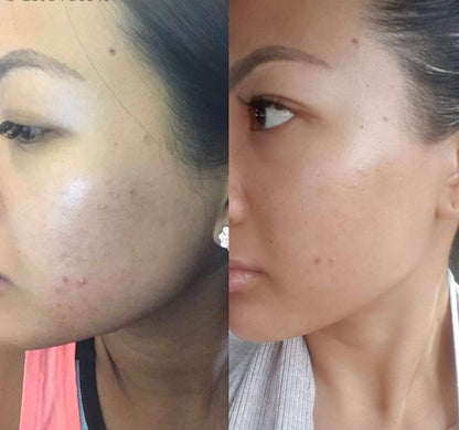 Glow Rice Ampoule Duo